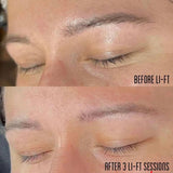 Li-FT Pigment Lightening Solution 15ml