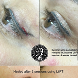 Li-FT Pigment Lightening Solution 15ml