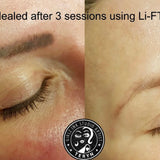 Li-FT Pigment Lightening Solution 15ml